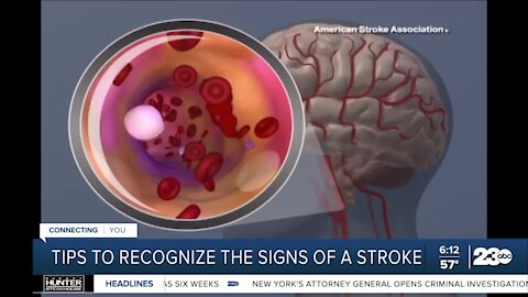 How to recognize the signs of a stroke