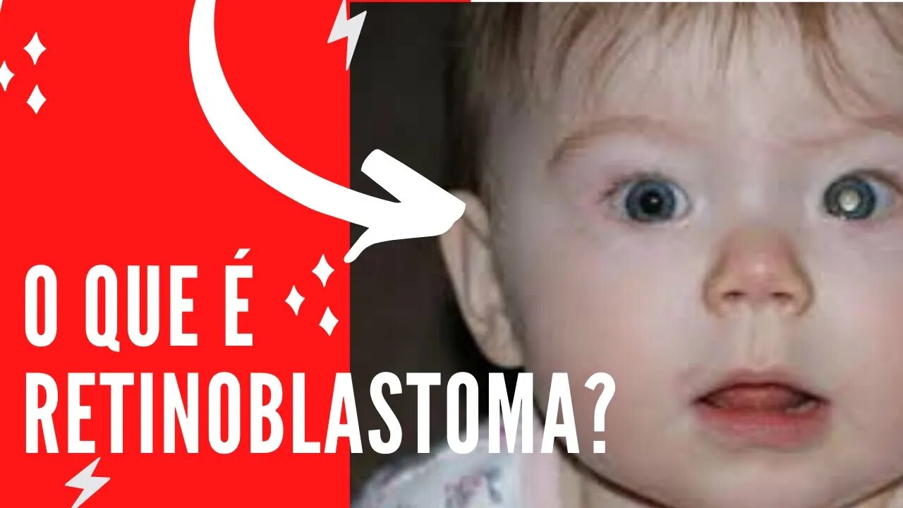 O QUE É Retinoblastoma?