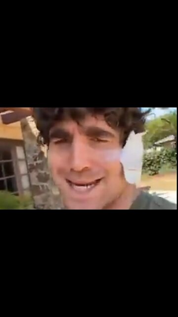 IMITATION OF TRUMP TALKING ABOUT HIS EAR