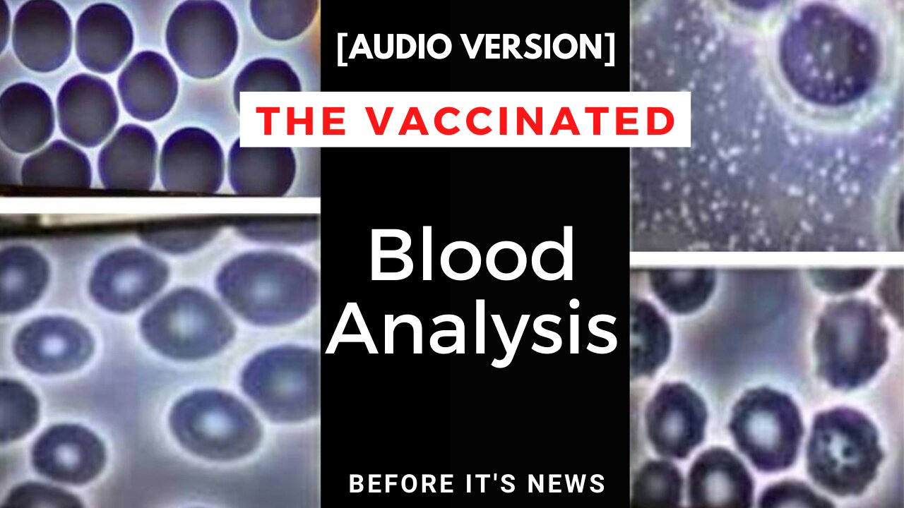 Shoking Live Blood Analysis After Vax [Audio Version]