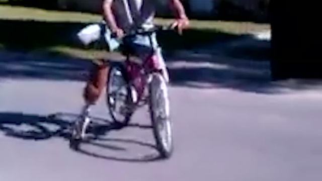 Man Loses His Prosthetic Leg On Bike Ride