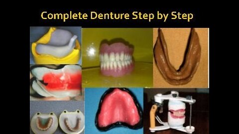 steps of complete denture