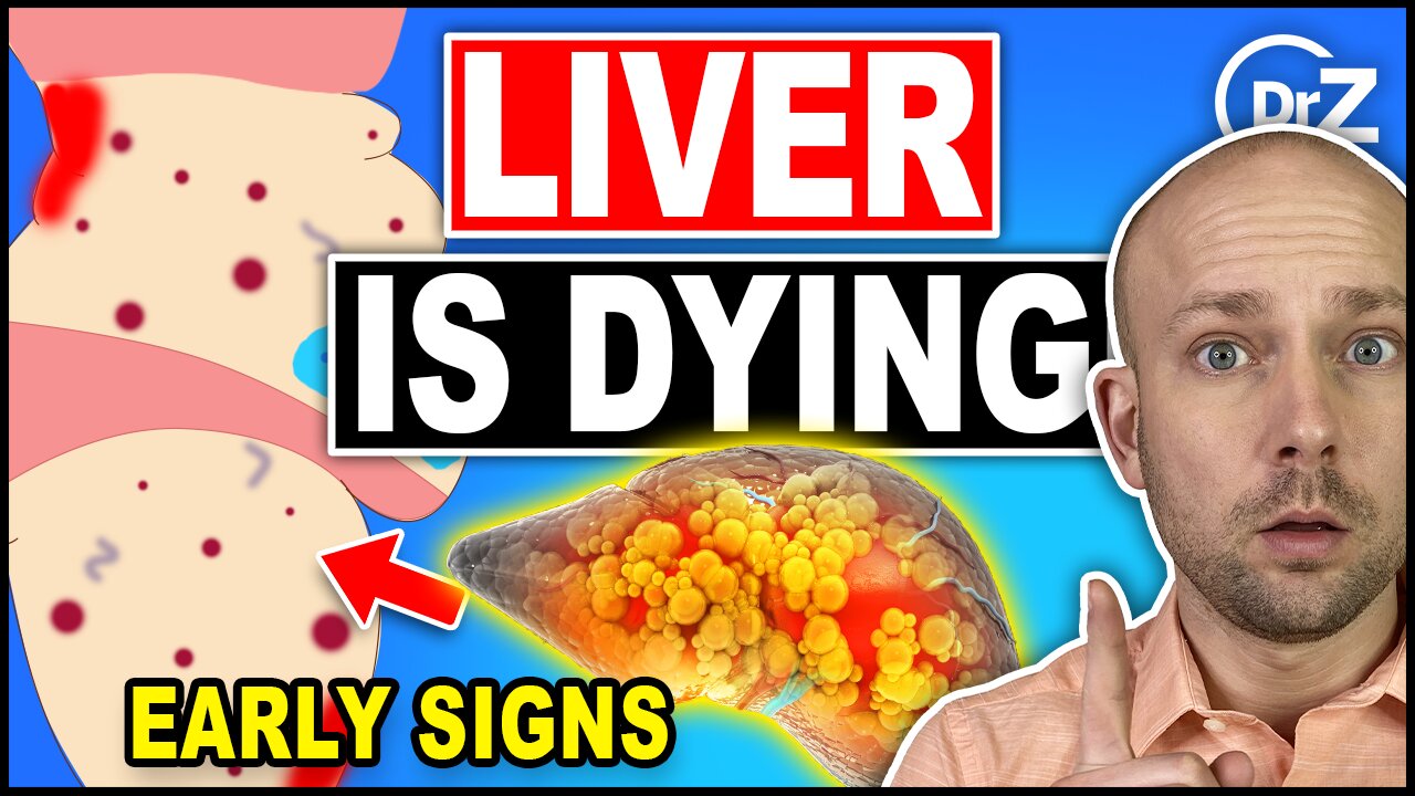 7 Unusual Signs That You Have Liver Damage - Doctor Explains