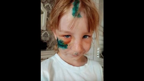 Ethnic Russian Girl 11 Years Old Gets Beaten By Older Ukrainian Girls