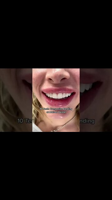 Dental And Teeth Hygiene