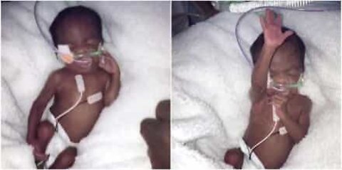 Premature baby brushes away his mother's hand!