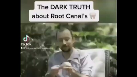 Root Canals