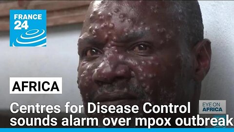 Africa's top health body sounds alarm over mpox outbreak