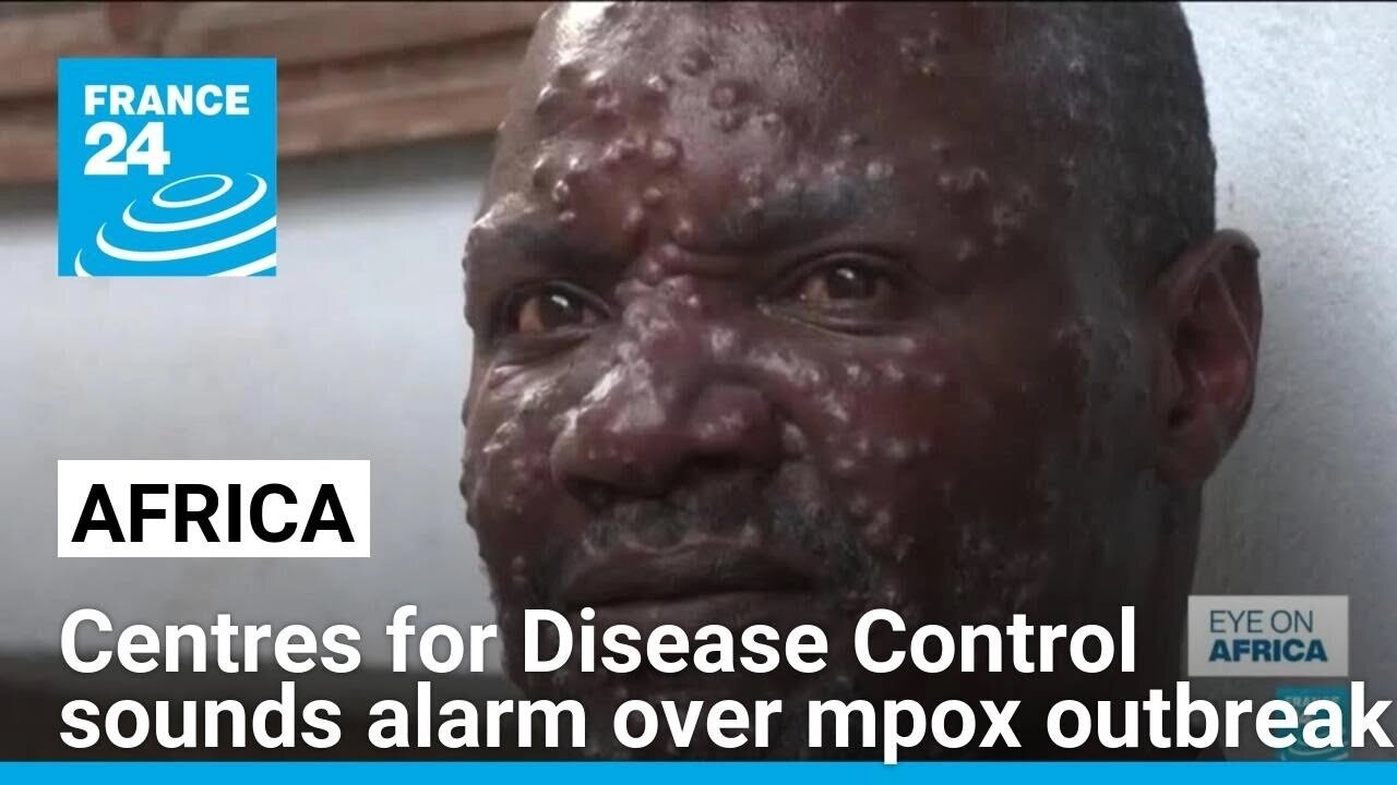 Africa's top health body sounds alarm over mpox outbreak