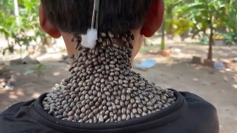 Imagine mais de 200 carrapatos grudados em seu pescoço