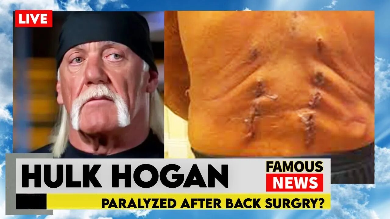 Is Hulk Hogan Paralyzed? WWE Legend Can’t Feel His Legs | Famous News