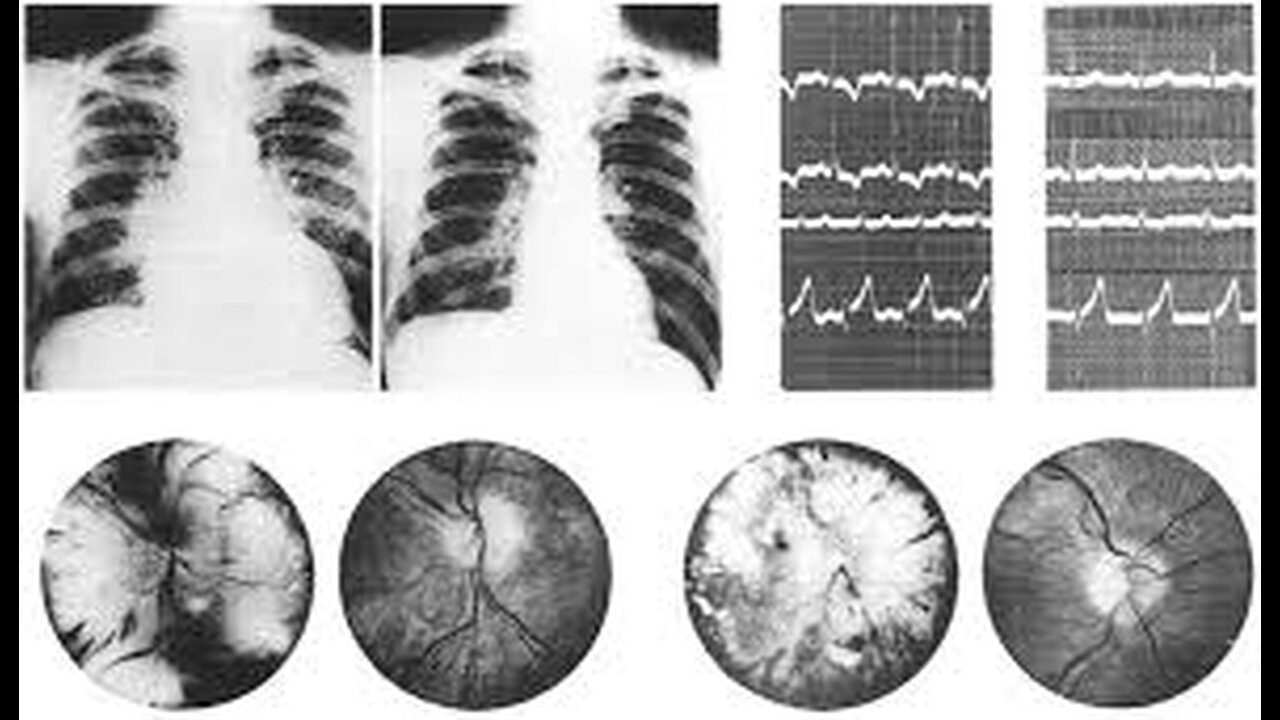 WALTER KEMPNER RULES!!