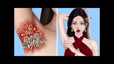 ASMR Removal Dog Ticks & Maggot Infected Armpit | Severely Injured Animation