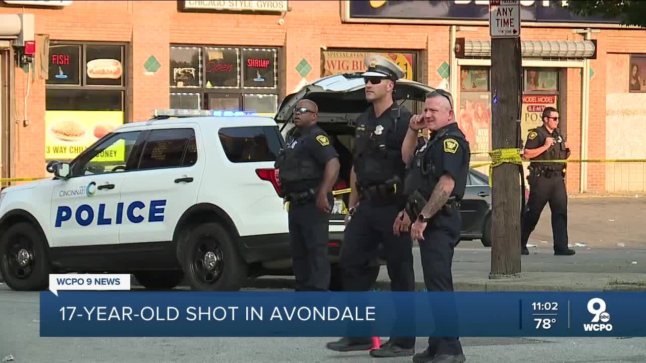 Police investigate Avondale shooting that injured 17-year-old