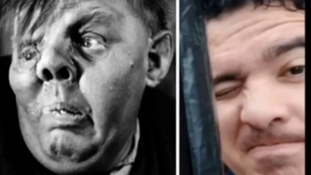 Yo .... el cuasimodo