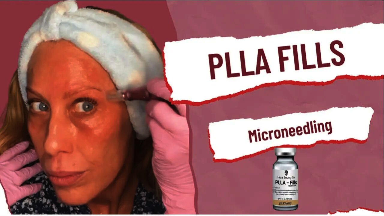 PLLA Fills *Wrinkle Free* Microneedling for Smooth Skin & Collagen - SASSY10 10% @ Glamderma