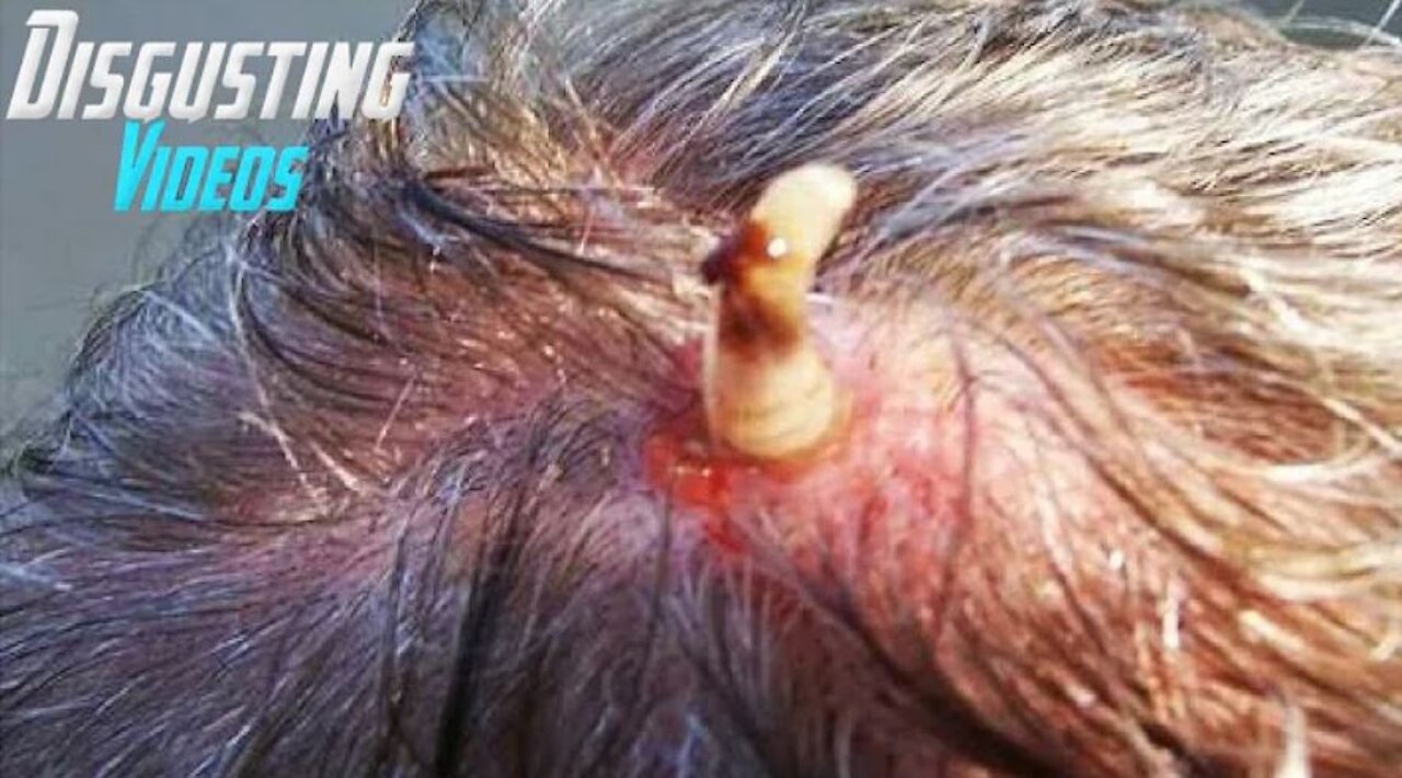 GET OUT of my head you MONSTER!! - HUGE Maggot Removal! WARNING!