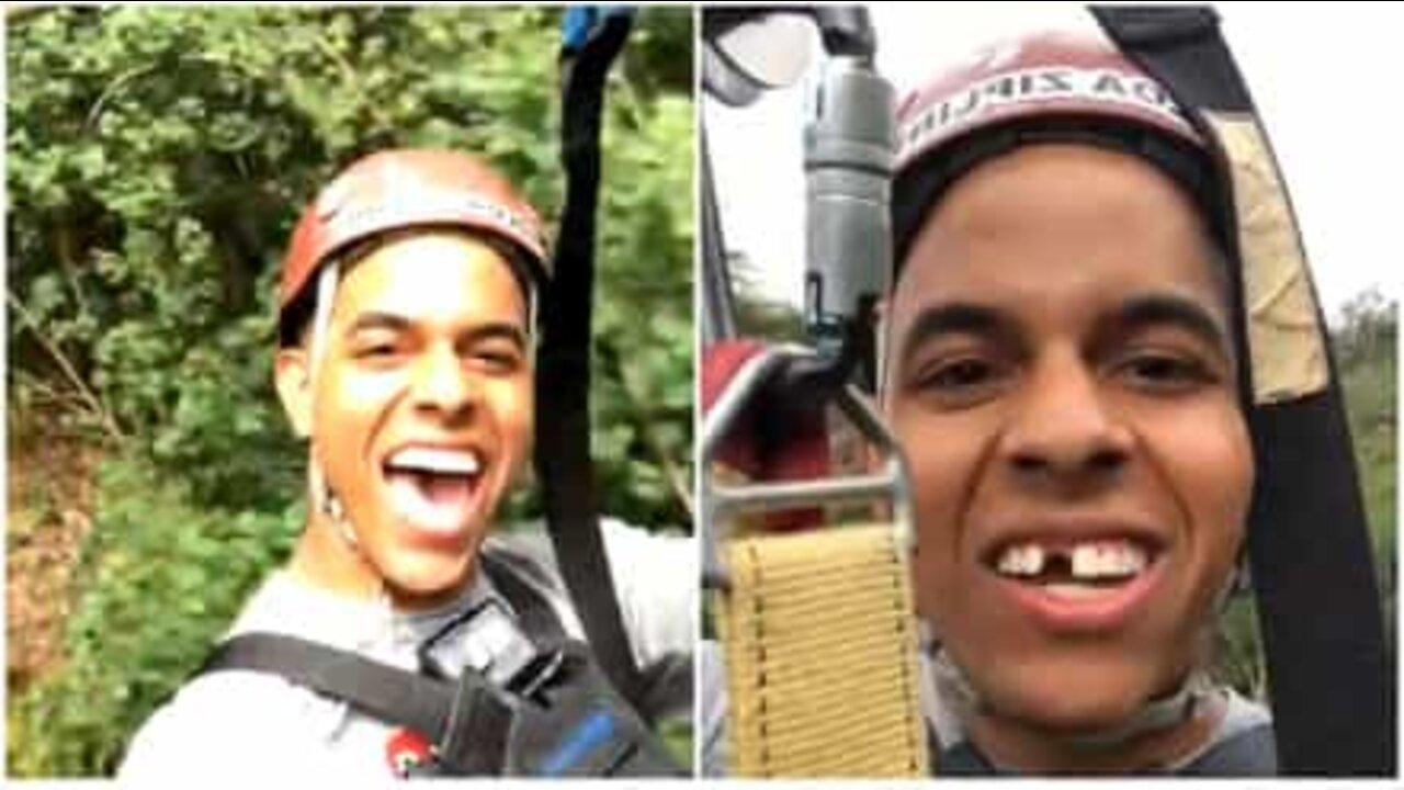 １０代の少年は、ハワイでジップラインをしているときに差し歯を失くしてしまう。