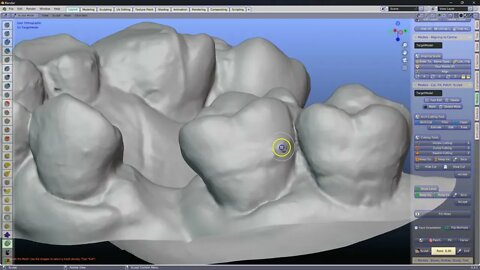 Denture Module