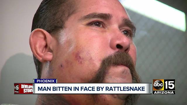 Coolidge man bitten in face by rattlesnake