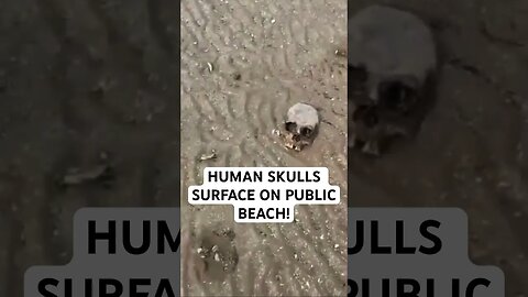 HUMAN SKULLS SURFACE ON PUBLIC BEACH!