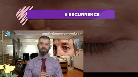 XANTHELASMA RECURRENCE