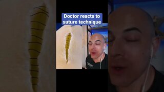 Doctor reacts to suture technique