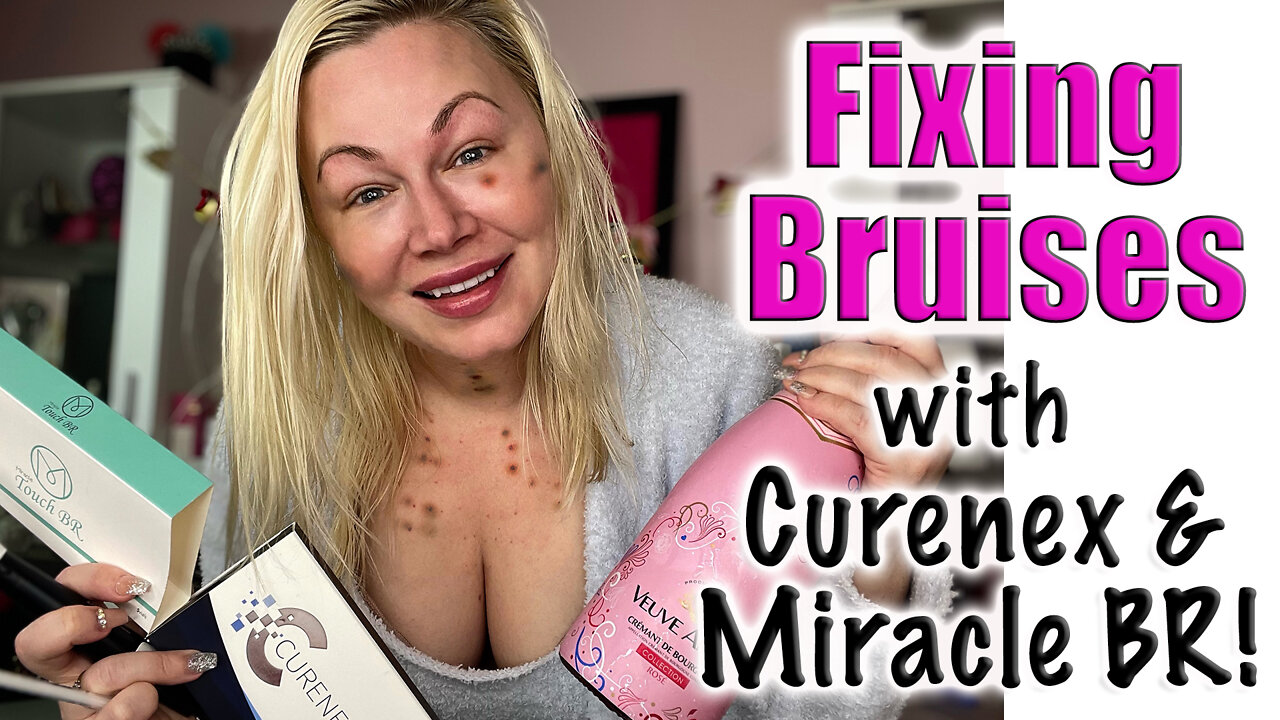 Fixing Bruises with Curenex and Miracle BR from www.acecosm.com | Code Jessica10 Saves you Money!