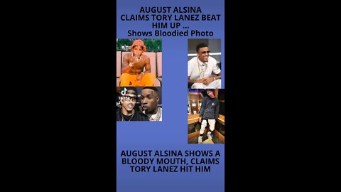 AUGUST ALSINA CLAIMS TORY LANEZ BEAT HIM UP ... Shows Bloodied Photo