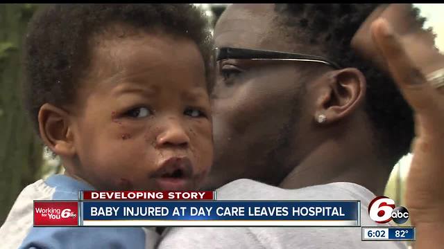 Baby Jesse released from Riley Hospital after being injured at Indy daycare