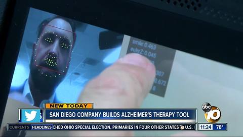 San Diego company builds Alzheimer's tool