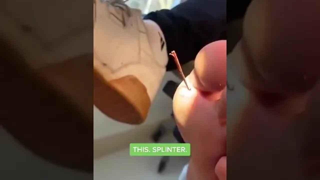 giant splinter
