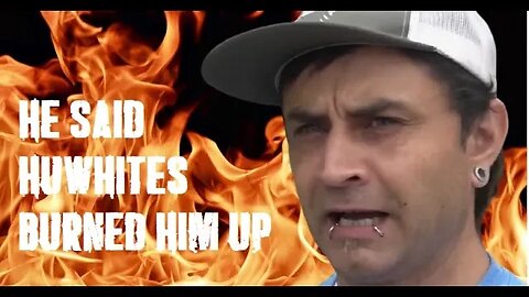 Gay man set on FYYYAH in homoseggsual attack!!