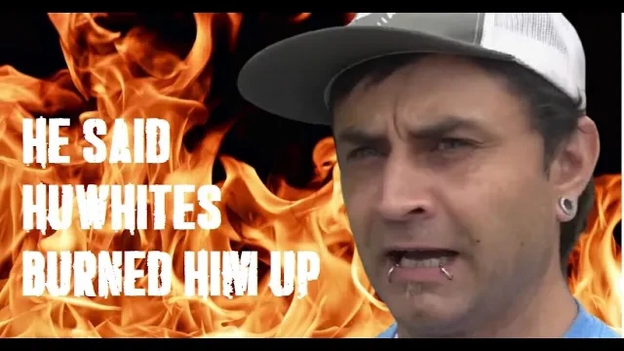 Gay man set on FYYYAH in homoseggsual attack!!