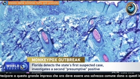 NWO, MONKEYPOX: Simulazione Vaiolo Scimmie, Nuclear Threat Initiative, marzo 2021