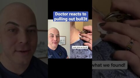 Doctor reacts to CRAZY bull3t extraction!