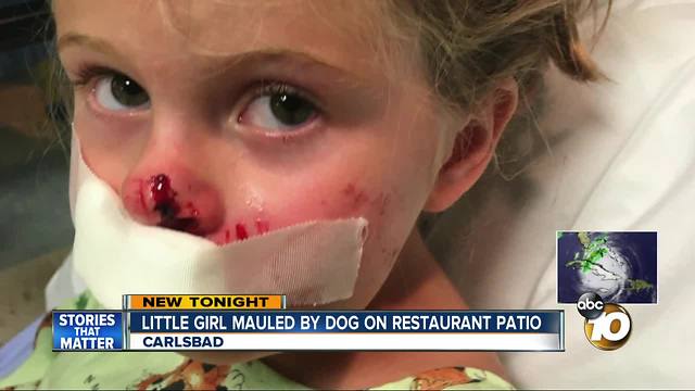 Little girl bitten by dog restaurant patio