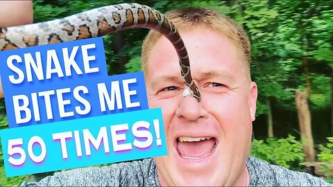 SNAKE BITES ME 50 TIMES!