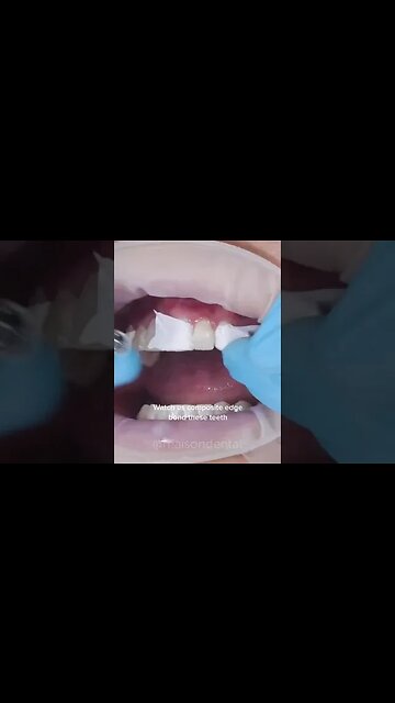 Dental And Teeth Hygiene