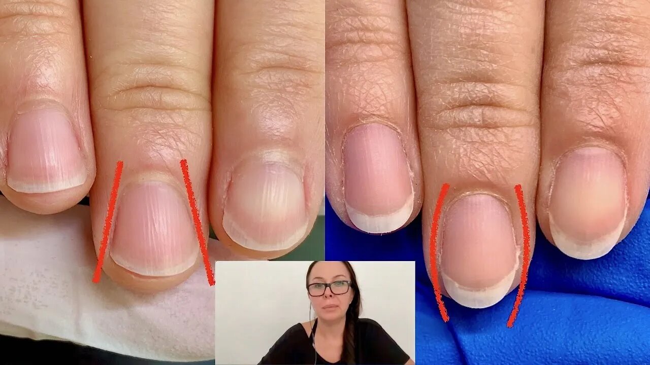 How I shaped these nails from fanning out to oval. [Nail technician explains]