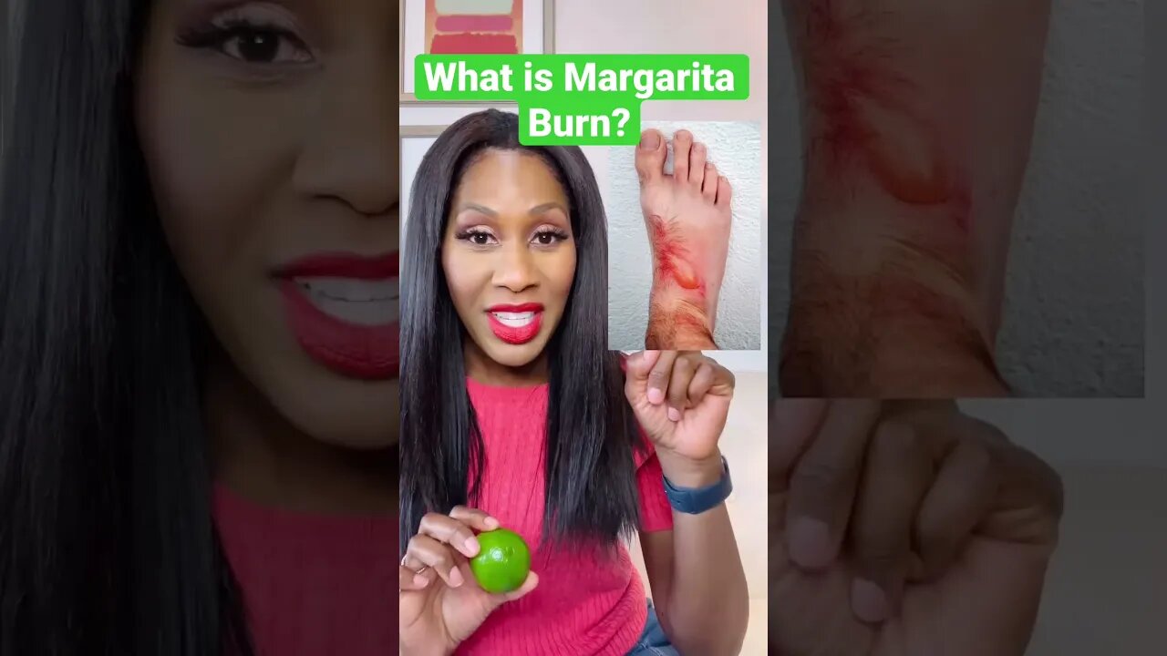 What is MARGARITA BURN? 🍹#shorts