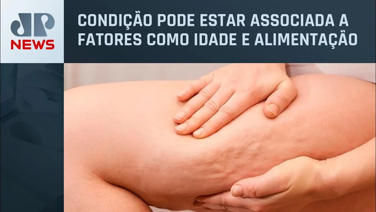 Lipodistrofia Ginóide: Celulite afeta 95% das mulheres