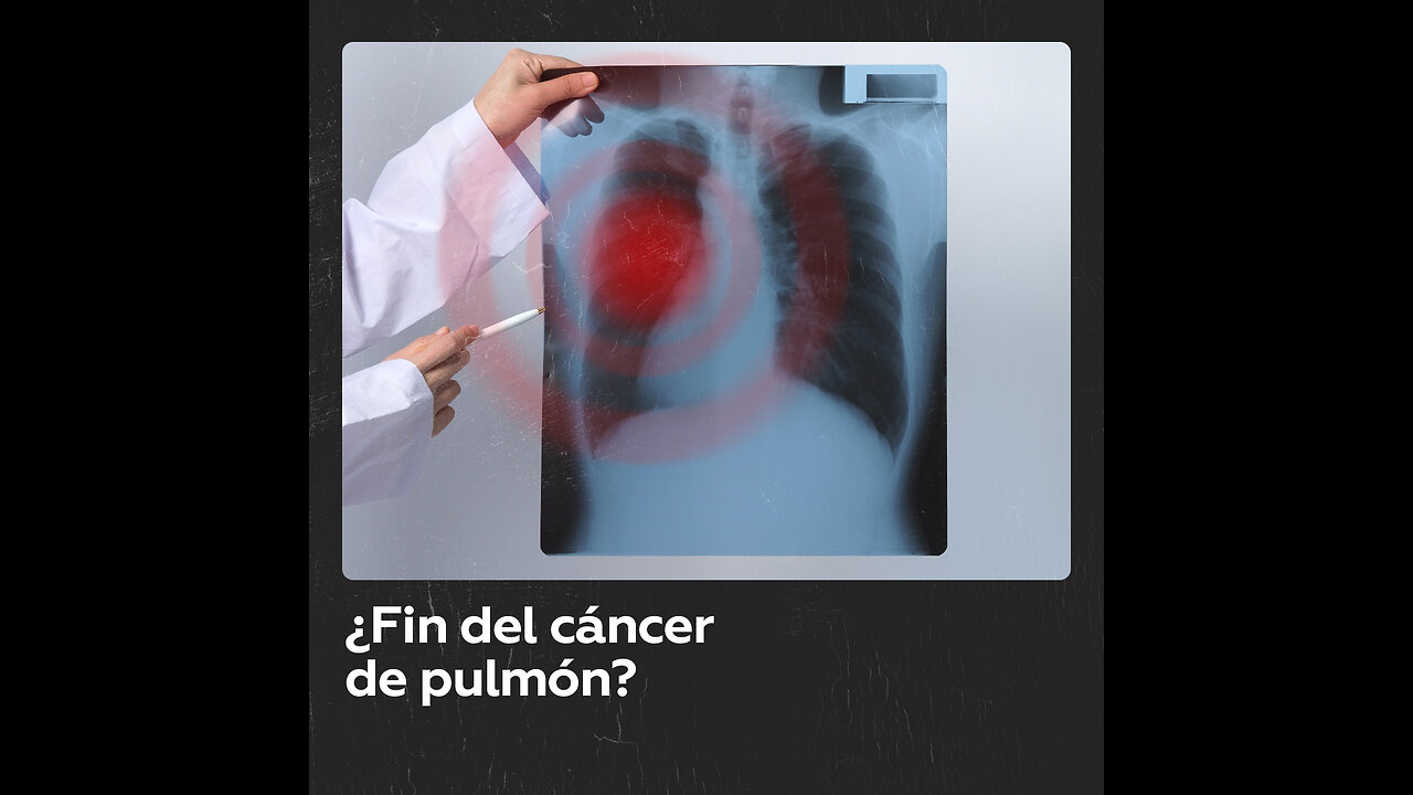 Comienzan pruebas de la primera vacuna contra cáncer de pulmón del mundo