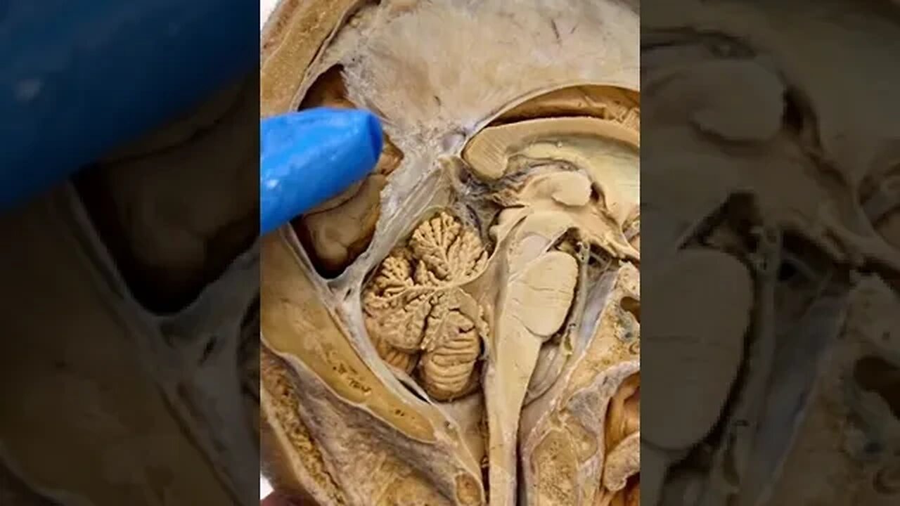 This Is What Connects Both Sides of Your Brain | The Corpus Callosum