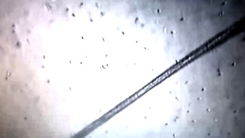 Nano robôs vivendo no esperma humano de vaxxinados?