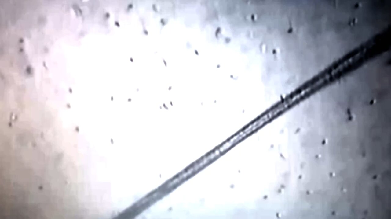 Nano robôs vivendo no esperma humano de vaxxinados?