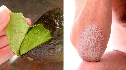 This Is Why You Should Rub An Avocado Peel On Your Elbows & Heels