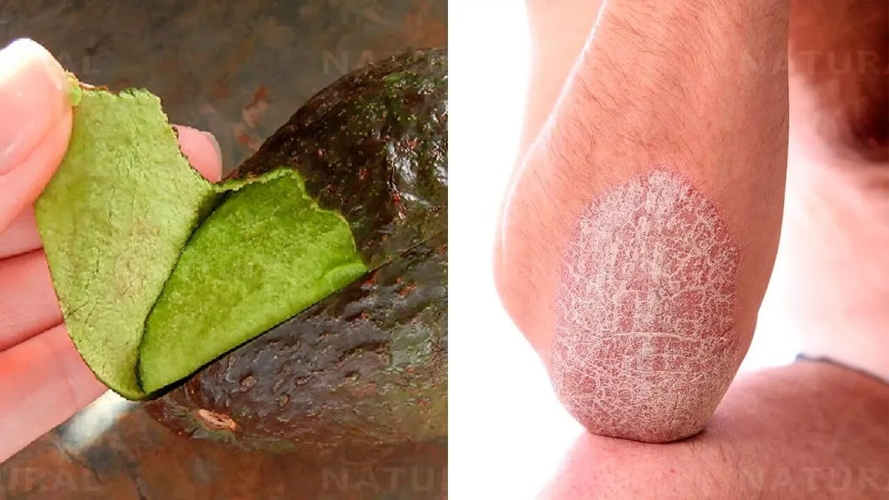 This Is Why You Should Rub An Avocado Peel On Your Elbows & Heels
