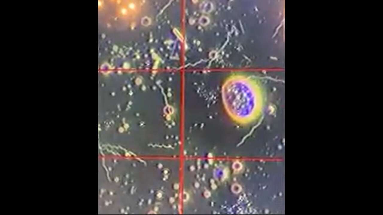 Amoeba's, Spirochetes. Streptococcus, Bacilli, Candida & Graphene Are Now Part of ALL Body Fluids