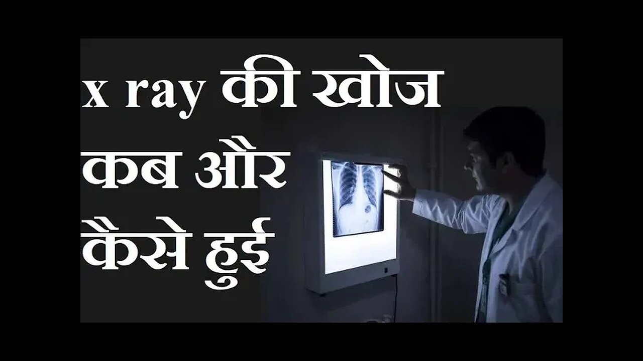 X RAY जैसी उपयोगी किरणों के आविष्कार की क्या कहानी है